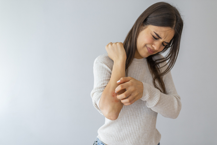 Women scratch the itch with hand Women scratching dry skin with hand,